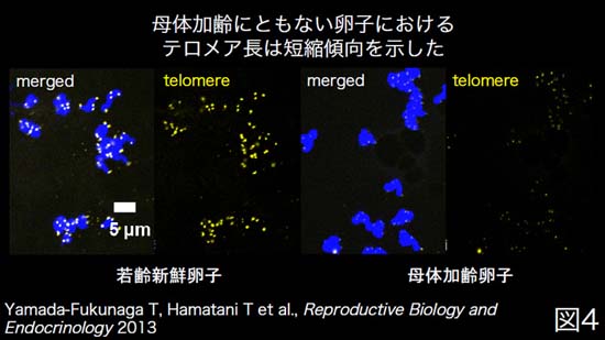 卵子の加齢機序の解明