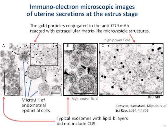 卵胞成熟、精子、初期胚発生、着床における卵子、初期胚と卵管、子宮内膜とのクロストークの解明：卵、精子、着床前期胚、あるいは胚盤胞から放出される分泌顆粒（exosome）に含まれるmiRNA解析、タンパクの網羅的解析