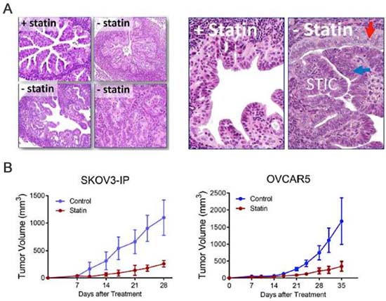 婦人科腫瘍に対するドラッグリポジショニング研究